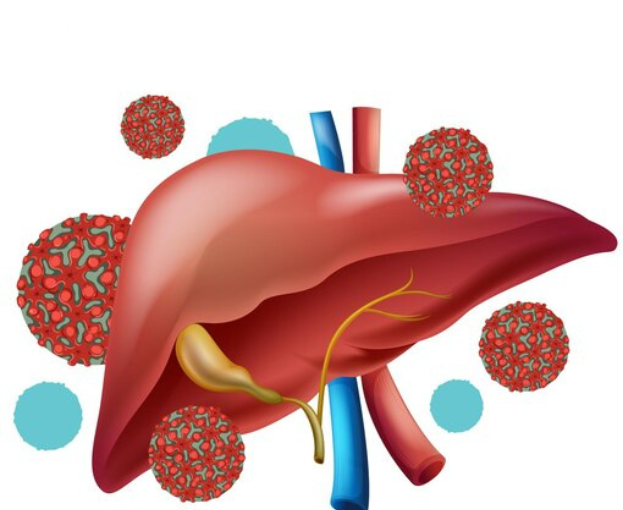 liver cancer